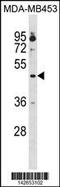 Opioid Receptor Kappa 1 antibody, 60-943, ProSci, Western Blot image 