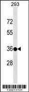 Testis Specific Protein Y-Linked 3 antibody, 59-088, ProSci, Western Blot image 