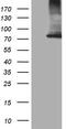 Carnitine Palmitoyltransferase 1B antibody, M03558, Boster Biological Technology, Western Blot image 