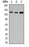 Huntingtin Interacting Protein 1 antibody, LS-B14586, Lifespan Biosciences, Western Blot image 