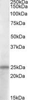 PACAP38 antibody, STJ71947, St John