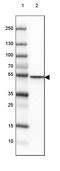 CD2 Cytoplasmic Tail Binding Protein 2 antibody, PA5-59603, Invitrogen Antibodies, Western Blot image 
