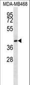 CD200 Receptor 1 antibody, LS-C168522, Lifespan Biosciences, Western Blot image 