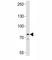 Bruton Tyrosine Kinase antibody, F52949-0.4ML, NSJ Bioreagents, Western Blot image 