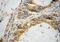VAMP Associated Protein A antibody, 15275-1-AP, Proteintech Group, Immunohistochemistry paraffin image 