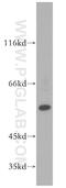 Peroxisome Proliferator Activated Receptor Gamma antibody, 16643-1-AP, Proteintech Group, Western Blot image 