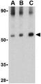 Mitochondrial Antiviral Signaling Protein antibody, GTX85480, GeneTex, Western Blot image 