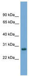 Activator Of Basal Transcription 1 antibody, TA342311, Origene, Western Blot image 