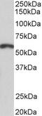 Peptidase Inhibitor 15 antibody, 42-983, ProSci, Western Blot image 