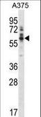 Protein Tyrosine Kinase 6 antibody, LS-C164563, Lifespan Biosciences, Western Blot image 