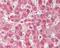 COX2 antibody, 49-472, ProSci, Immunohistochemistry paraffin image 