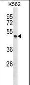 Purinergic Receptor P2X 1 antibody, LS-C163313, Lifespan Biosciences, Western Blot image 