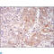 SLP-65 antibody, LS-C812514, Lifespan Biosciences, Immunohistochemistry paraffin image 