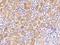 VPS52 Subunit Of GARP Complex antibody, 204363-T08, Sino Biological, Immunohistochemistry paraffin image 