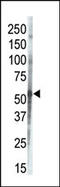 Casein Kinase 1 Gamma 3 antibody, 62-887, ProSci, Western Blot image 