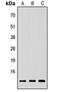 Neuregulin 4 antibody, LS-C356227, Lifespan Biosciences, Western Blot image 