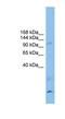 Calsyntenin 3 antibody, NBP1-59713, Novus Biologicals, Western Blot image 