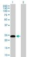 Gap Junction Protein Beta 5 antibody, H00002709-B01P, Novus Biologicals, Western Blot image 