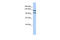 RNA Binding Motif Protein 5 antibody, 25-444, ProSci, Western Blot image 