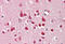 Nuclear Receptor Subfamily 3 Group C Member 1 antibody, MBS249109, MyBioSource, Immunohistochemistry frozen image 