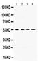 Matrix Metallopeptidase 8 antibody, GTX03673, GeneTex, Western Blot image 