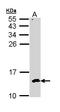 CDC28 Protein Kinase Regulatory Subunit 2 antibody, LS-C186230, Lifespan Biosciences, Western Blot image 