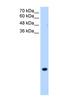 Transmembrane protein 75 antibody, NBP1-59685, Novus Biologicals, Western Blot image 