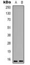 Proliferation And Apoptosis Adaptor Protein 15 antibody, orb338960, Biorbyt, Western Blot image 