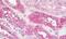 Early Endosome Antigen 1 antibody, MBS248911, MyBioSource, Immunohistochemistry paraffin image 
