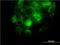 Integrin Subunit Alpha 2 antibody, H00003673-M01, Novus Biologicals, Immunocytochemistry image 