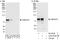 ZMYND4 antibody, A303-616A, Bethyl Labs, Immunoprecipitation image 
