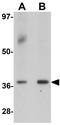 Spermatogenesis Associated 1 antibody, GTX32038, GeneTex, Western Blot image 
