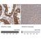 VPS37A Subunit Of ESCRT-I antibody, NBP1-83528, Novus Biologicals, Western Blot image 