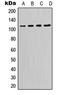 Phosphatidylinositol-4,5-Bisphosphate 3-Kinase Catalytic Subunit Delta antibody, LS-C352664, Lifespan Biosciences, Western Blot image 