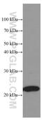 TAR DNA Binding Protein antibody, 66079-1-Ig, Proteintech Group, Western Blot image 