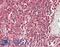 Smoothened, Frizzled Class Receptor antibody, LS-B13597, Lifespan Biosciences, Immunohistochemistry paraffin image 