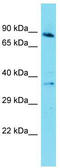 G Protein-Coupled Receptor 141 antibody, TA331550, Origene, Western Blot image 