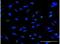 Zinc Finger Protein 100 antibody, H00163227-M01-100ug, Novus Biologicals, Immunocytochemistry image 