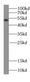 TMPO antibody, FNab04693, FineTest, Western Blot image 