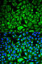 Phosphatidylethanolamine Binding Protein 1 antibody, STJ24954, St John