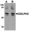 Golgi Membrane Protein 1 antibody, orb75291, Biorbyt, Western Blot image 