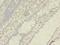 ADAM Metallopeptidase Domain 10 antibody, LS-C375148, Lifespan Biosciences, Immunohistochemistry frozen image 