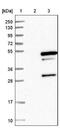 Tropomodulin 4 antibody, NBP1-80745, Novus Biologicals, Western Blot image 