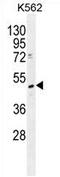 TRNA Methyltransferase 2 Homolog B antibody, AP54358PU-N, Origene, Western Blot image 