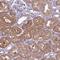 Scratch Family Transcriptional Repressor 1 antibody, NBP1-92369, Novus Biologicals, Immunohistochemistry frozen image 