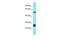 Putative Protein FAM90A10P                     antibody, A19265, Boster Biological Technology, Western Blot image 