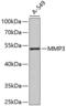 Matrix Metallopeptidase 3 antibody, 18-643, ProSci, Western Blot image 