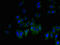 GLI Pathogenesis Related 1 antibody, LS-C285511, Lifespan Biosciences, Immunofluorescence image 