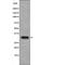 Death Associated Protein Kinase 1 antibody, PA5-64507, Invitrogen Antibodies, Western Blot image 