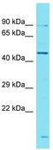 Ankyrin Repeat Domain 40 antibody, TA333573, Origene, Western Blot image 